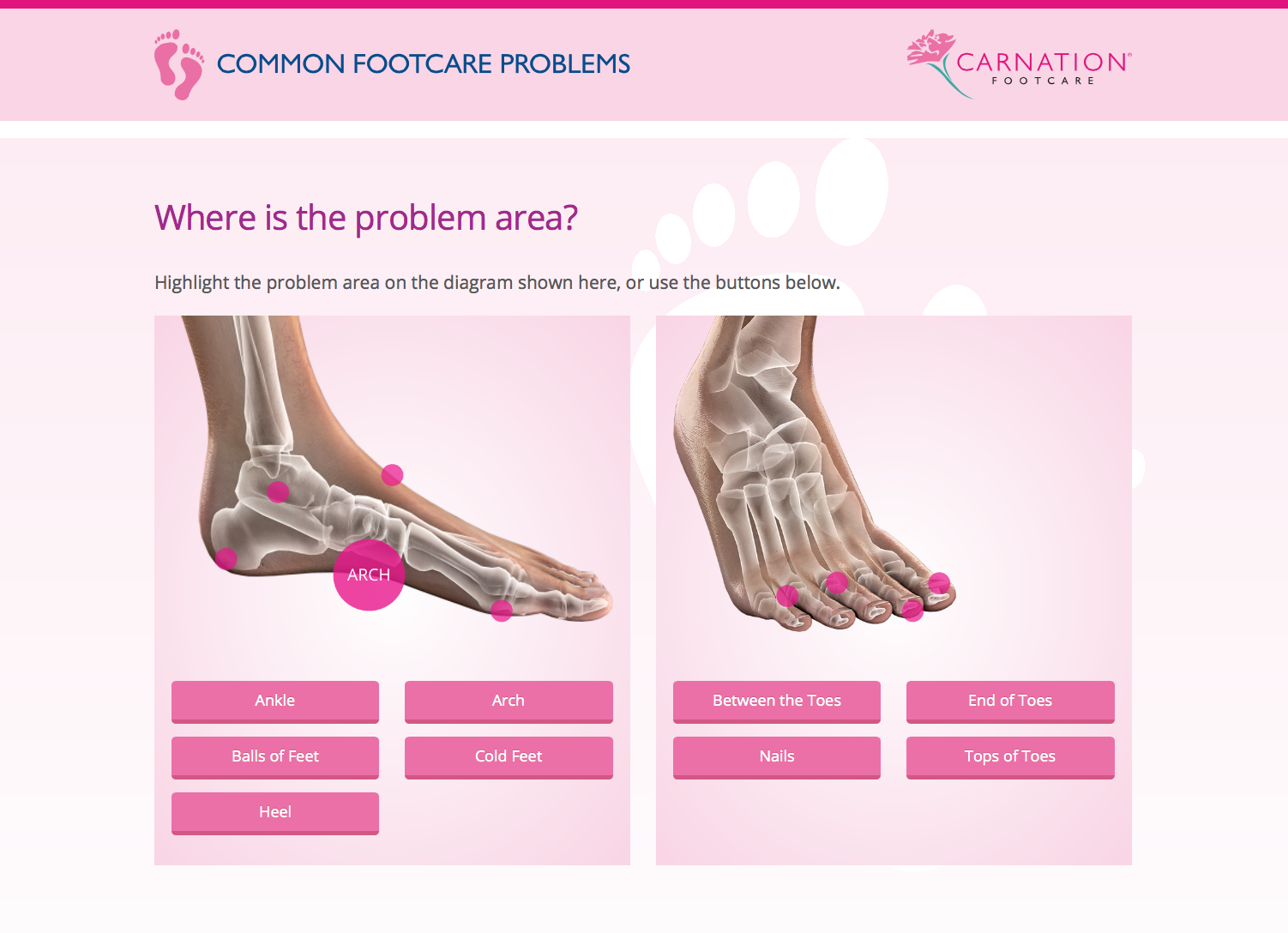 Common Footcare Problems